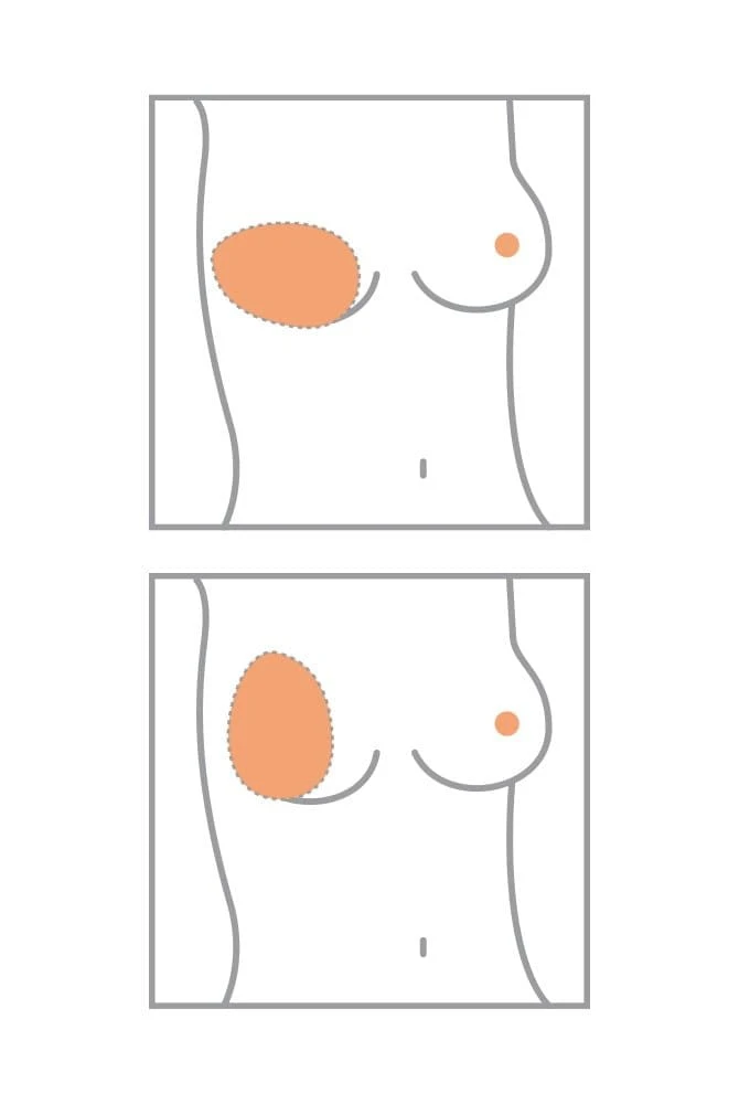 Amoena Teilprothese Balance Natura Thin Oval – Bild 3